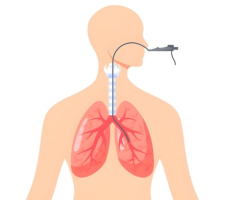 Best Bronchoscopy Doctor in Borivali